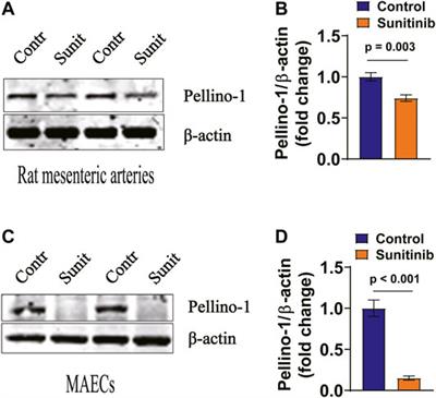 Insulin Resistance and Pellino-1 Mediated Decrease in the Activities of Vasodilator Signaling Contributes to Sunitinib-Induced Hypertension